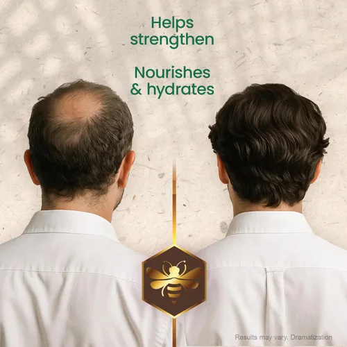 Miniatura 4 de TIO NACHO Herbolaria Mexicana Shampoo fortalecedor de cabello, con jalea real, ginseng, aloe vera, trigo, jojoba, 14 onzas líquidas