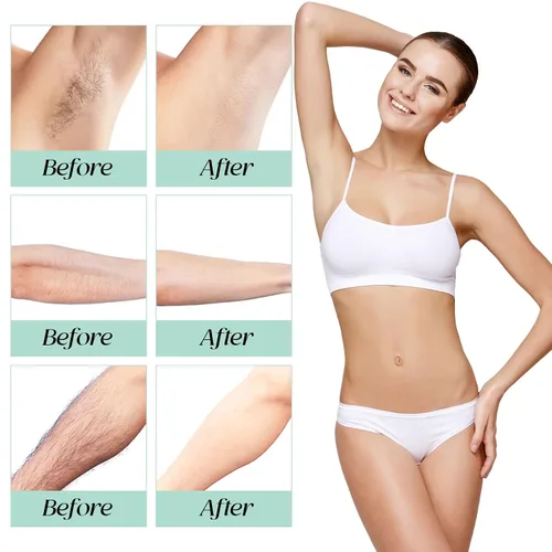 Miniatura 3 de Crema depilatoria: depilación íntima/privada para mujeres y hombres, loción depilatoria sin dolor para bikini, piernas, brazos, axilas y cuerpo