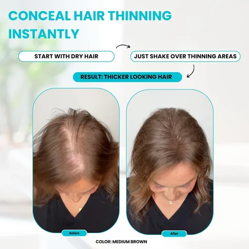 Miniatura 4 de SURETHIK Fibras capilares para adelgazar el cabello, construyendo fibras capilares para ocultar el cabello delgado, cabello de aspecto