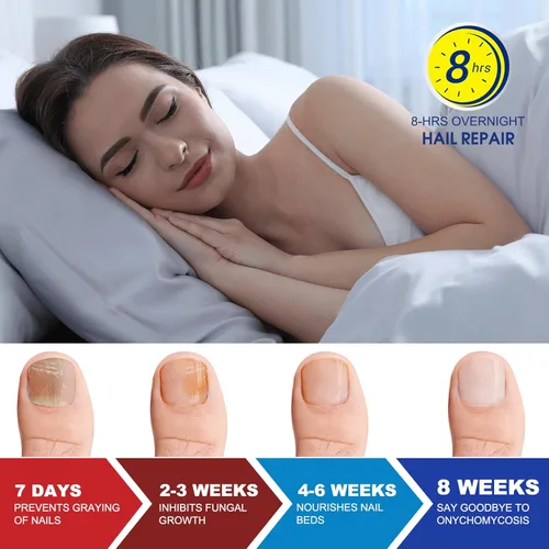 Miniatura 7 de Tratamiento de hongos en las uñas de los pies extra fuerte – 21 parches de uñas de hongos, parches de reparación de uñas, 8 horas de adherencia