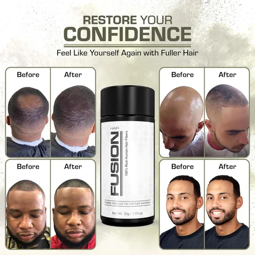 Miniatura 6 de Hair Fusion - Fibras de cabello humano 100% reales - Oculta el cabello calvo y adelgazante - Retoque de raíz - Volumizador - Unisex