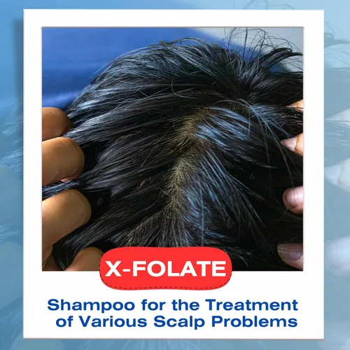Miniatura 5 de Mediceuticals X-Folate Shampoo Champú Anticaspa para Mujeres y Hombres – Control Persistente de la Caspa – Para la acumulación de cuero cabelludo