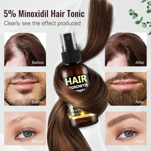 Miniatura 3 de 5% Minoxidil para Hombres y Mujeres, Spray de Rebrotes Capilares de Fórmula Avanzada y Solución Tópica para Cabello y Barba Ralos, Resultados