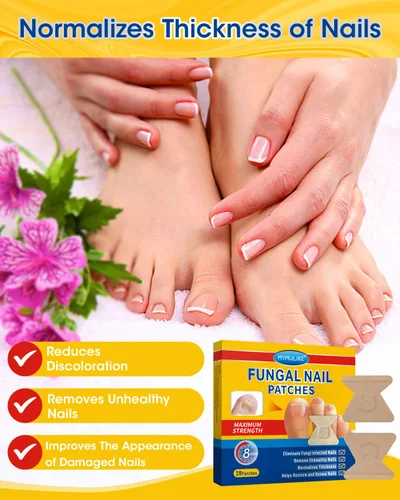 Miniatura 2 de MYMULIKE Parches de reparación de uñas extra fuertes, 28 unidades, reparación de uñas para uñas dañadas, parches de renovación de uñas nocturnas