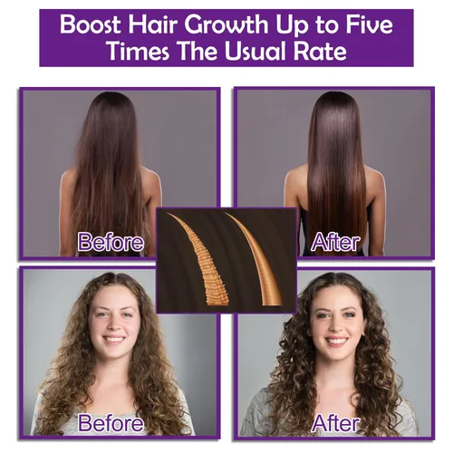 Miniatura 7 de Set de champú y acondicionador para el crecimiento del cabello con aceites de romero, biotina, argán y ricino para cabello adelgazante, dañado