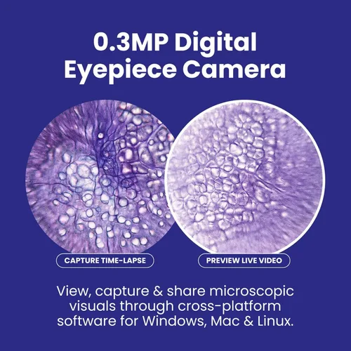 Miniatura 5 de AmScope Serie B120 Microscopio compuesto binocular LED para estudiantes y profesionales - Aumento 40X a 2500X - Incluye cámara USB 2.0 de 0.3MP