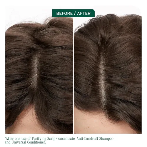 Miniatura 2 de Biolage Scalp Sync - Concentrado purificador - Tratamiento exfoliante y aclarador del cuero cabelludo seco, refrescante y revitalizante, mezcla