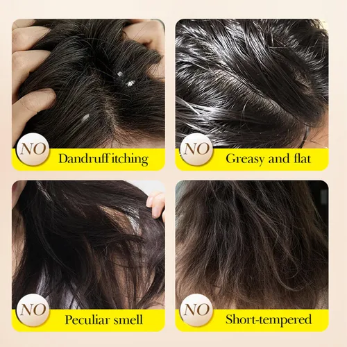 Miniatura 4 de Grospe Barra de champú de aceite esencial de lavanda, limpieza profunda e hidratación, alivia la picazón y la caspa, deja el cabello suave