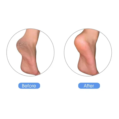 Miniatura 5 de Piedra pómez Hamalaya naturales de tierra Lava, PREMIUM Herramienta Pedicura y exfoliación, Removedor de callos para pies, suavizante de piel, piel