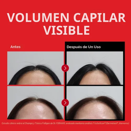 Miniatura 2 de Dr.FORHAIR Folligen Shampoo Cuidado coreano del cabello Champú clarificador del cuero cabelludo Cabello de aspecto más completo, 16.91 onzas