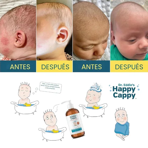 Miniatura 6 de Happy Cappy Champú medicado y gel de baño - Champú para caspa de bebé, ayuda a la tapa de la cuna y la dermatitis seborreica, reduce las escamas