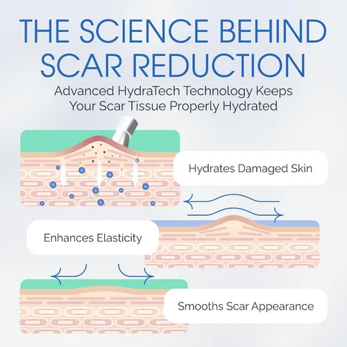 Miniatura 7 de Suero de gel para cicatrices de silicona 100% – Aplicador de cepillo ultrasuave para procedimientos cosméticos y exfoliaciones faciales, cuidado