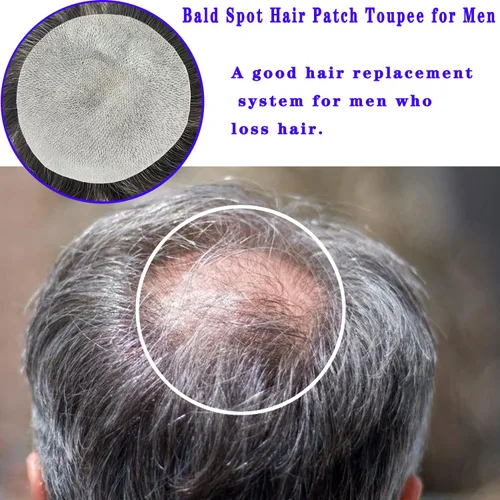 Miniatura 5 de Voloria Parche para el cabello de punto calvo para hombres, 3.15 x 3.15 pulgadas, parches de pelo completo de poliuretano para cubrir la base