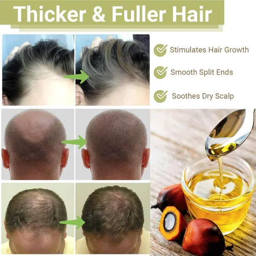 Miniatura 5 de Minnah - Aceite de batana para el crecimiento del cabello líquido 4 en 1, 1 unidad Crack Aceite de Crecimiento del Cabello Con Romero, Semilla De