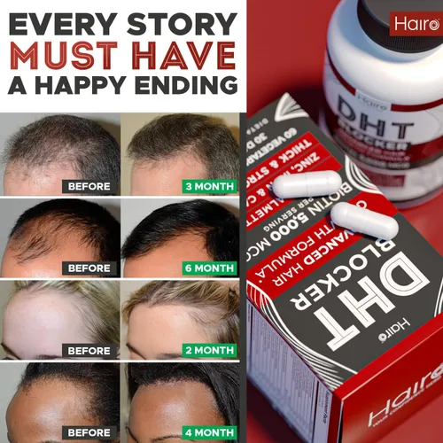 Miniatura 5 de DHT Blocker Suplemento para el Crecimiento del Cabello - Biotina de Alta Potencia y Saw Palmetto para el Recrecimiento del Cabello - Tratamientos