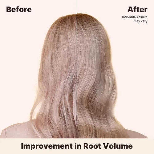 Miniatura 5 de Acondicionador voluminizador profundo para cabello adelgazante – Cuidado del cabello coreano con biotina y pantenol – Reparación de daños