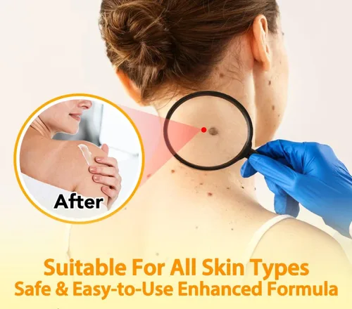 Miniatura 8 de Bee Venom Cream, nueva crema reparadora de tratamiento de la piel para todas las partes del cuerpo, gel de miel suave profesional para todo