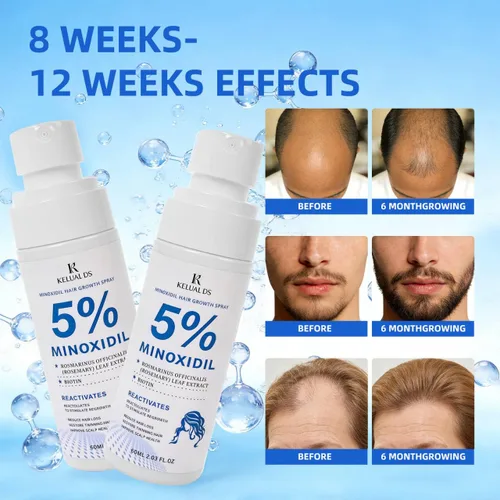 Miniatura 5 de Crecimiento del cabello de minoxidil al 5% para hombres y mujeres, fórmula mejorada, puede promover un suero de crecimiento del cabello más rápido