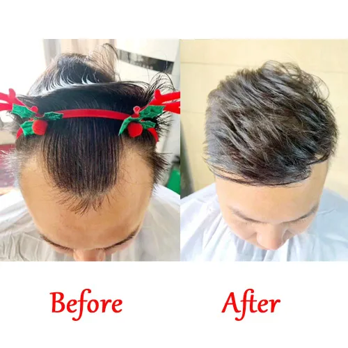Miniatura 7 de Tupé de línea capilar para hombre, 0.7 x 6 pulgadas, en forma de V, color negro natural, para hombres, cabello humano real, tupé, piel suave y fina