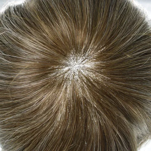 Miniatura 133 de Sistema de repuesto de cabello humano europeo con encaje frontal suizo para hombre, tupé para hombre, pieza de cabello, nudo blanqueado, línea #17