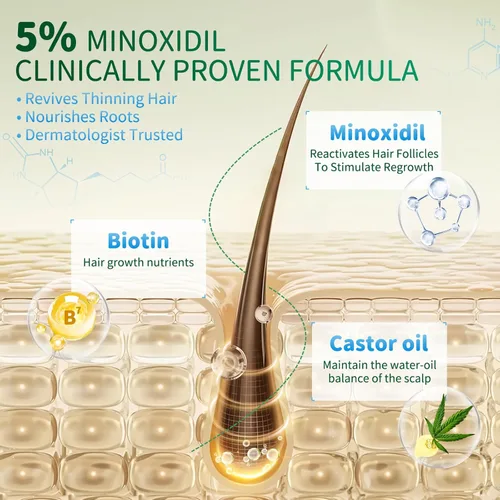 Miniatura 5 de Spray de minoxidil al 5 % para el crecimiento del cabello, paquete de 4 (8.12 onzas), para hombres y mujeres, tratamiento de crecimiento del cabello