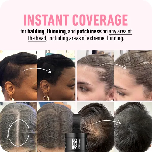 Miniatura 2 de Boldify Build & Conceal Bundle - Fibra capilar y polvo de línea capilar (rubio oscuro): espesante indetectable para cabello fino, retoque