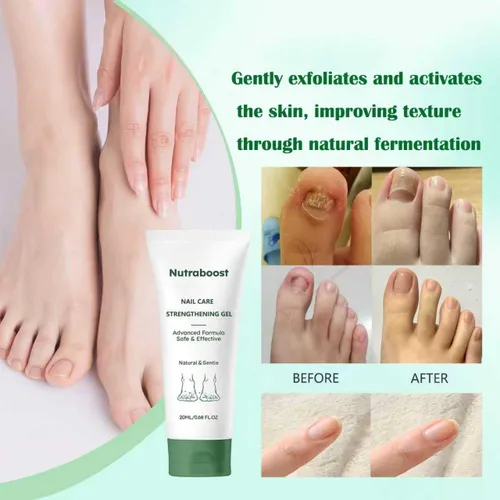 Miniatura 4 de Nutraboost Gel natural para el cuidado de uñas, suero fortalecedor para cutículas para uñas dañadas y quebradizas, 0.7 fl oz (1 unidad) (2 unidades)
