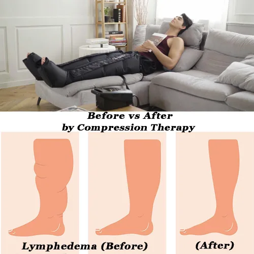 Miniatura 3 de Botas de terapia de compresión de aire para pies de LONGEST, bombas de linfedema para piernas Sistema de recuperación linfática de compresión