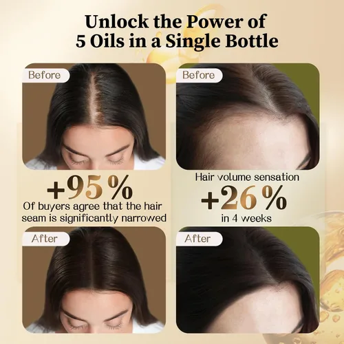 Miniatura 9 de Aceite de batana para el crecimiento del cabello y aceite de Cinchona incluye aplicador de cuero cabelludo, reparación del cuero cabelludo y cabello