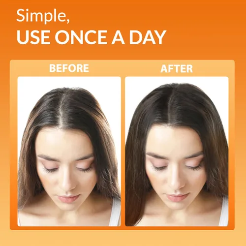 Miniatura 9 de Youthfully Beautiful Rice Nutri Spray and Shampoo Bar Set Thickens Hair Support Healthy Growth Rice Coffee Extract for Thinning Hair and Hair Loss
