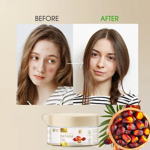 Miniatura 7 de Aceite de batana 100% crudo prensado en frío, potente aceite natural para el crecimiento del cabello y curación de la piel, certificado orgánico
