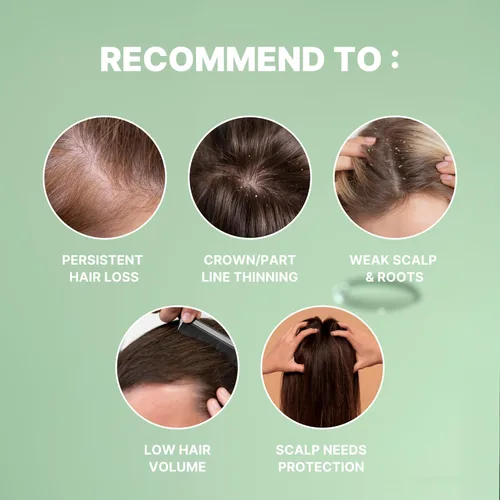 Miniatura 3 de Suero intensivo para el crecimiento del cabello del cuero cabelludo coreano, ampolla sin enjuague de biotina y pantenol para pérdida de cabello