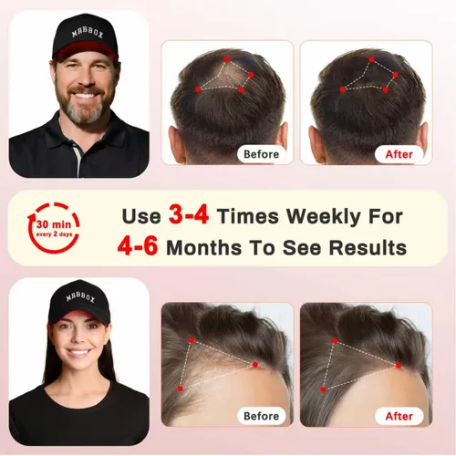 Miniatura 5 de Gorra de crecimiento del cabello con luz roja, 528 emisores de luz total, terapia de luz roja para el cabello, ajuste ajustable, sesiones en casa