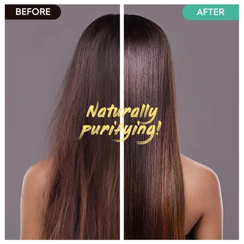 Miniatura 3 de Barra de champú de árbol de té MARS MADE 2.0 - Jabón de baño sólido y champú para el cabello natural hidratante y humectante para el exceso de Árbol