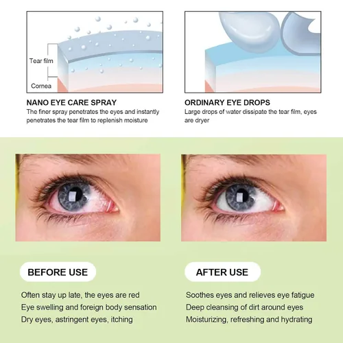 Miniatura 4 de Vaporizador de ojos con carga USB, espray de cuidado de mano para el cuidado de los ojos, máquina de limpieza hidratante portátil para mujeres