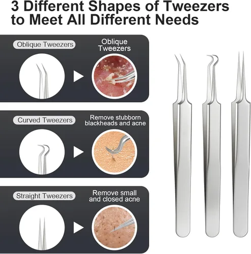 Miniatura 3 de Kit de herramientas de eliminación de espinillas de acero inoxidable tratado térmicamente, 12 piezas, extractor de comedona para acné facial