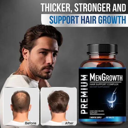 Miniatura 6 de NutraPro Vitaminas para el crecimiento del cabello para hombres, suplemento anti pérdida de cabello, píldoras de crecimiento del cabello y barba