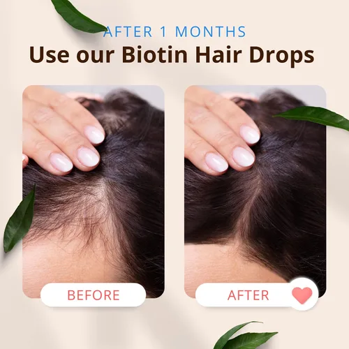 Miniatura 4 de Morfose Biotin Hair Drop - Solución nutritiva para el cuidado del cabello para promover el crecimiento, fortalecer y mejorar la textura, adecuada