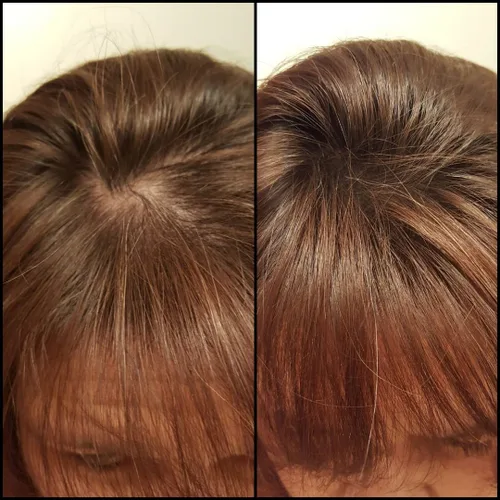 Miniatura 4 de Caboki Fibras capilares para adelgazar el cabello con aplicador de fibra capilar incorporado, fibra capilar a base de plantas para hombres