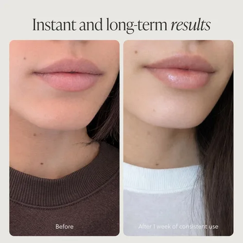 Miniatura 5 de Bálsamo labial de calvo alimentado con hierba, máscara para dormir labial, hidratante durante la noche, bálsamo labial hidratante natural y limpio