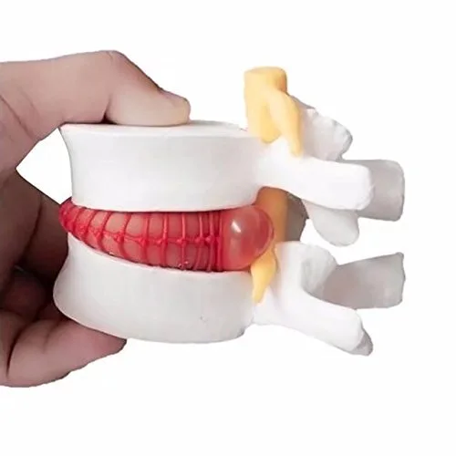 Miniatura 2 de DENTAL Color blanco oral 1:1.5 vértebras lumbares humanas anatómicas degenerativas lumbares modelo de columna vertebral humana US Stock