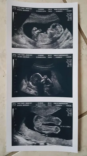 Miniatura 5 de Broma 2D personalizada tira de ultrasonido falso de 3 fotos
