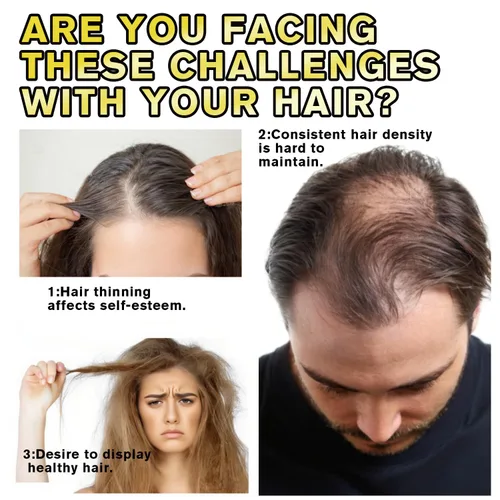 Miniatura 2 de 5% de crecimiento del cabello de minoxidil para hombres y mujeres, suero de crecimiento del cabello de minoxidil, promueve el crecimiento