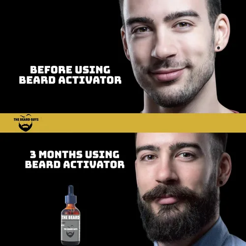 Miniatura 8 de Aceite de crecimiento de barba de minoxidil al 5%, 2 onzas