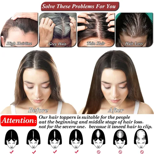 Miniatura 6 de JGS1996 Toppers de cabello humano real para mujer, 150% de densidad, hecha a mano, base de encaje, peluca de cabello Remy con piezas de cabello
