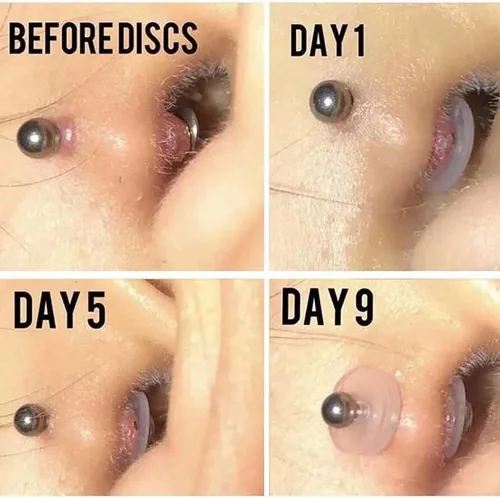 Miniatura 7 de Bloomfall Disco de perforación transparente para tratamiento de perforación de nariz, aretes de silicona para almohadillas curativas de queloides