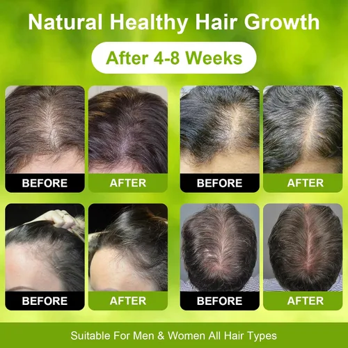 Miniatura 6 de Dr. Sebi Aceite de batana 100% crudo para el crecimiento del cabello, aceite natural y sin refinar, aumenta el grosor y el brillo, repara el daño