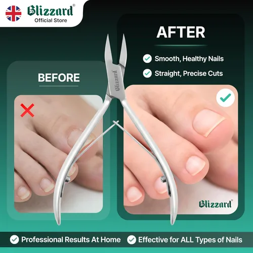 Miniatura 5 de Blizzard - Cortaúñas encarnadas, podólogo, podólogo, uñas gruesas para personas mayores, pinzas encarnadas para hombres, herramienta de podología
