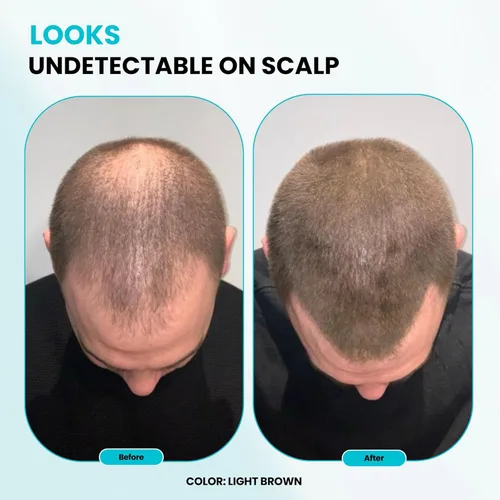 Miniatura 7 de SURETHIK Fibras capilares para adelgazar el cabello, construyendo fibras capilares para ocultar el cabello delgado, cabello de aspecto
