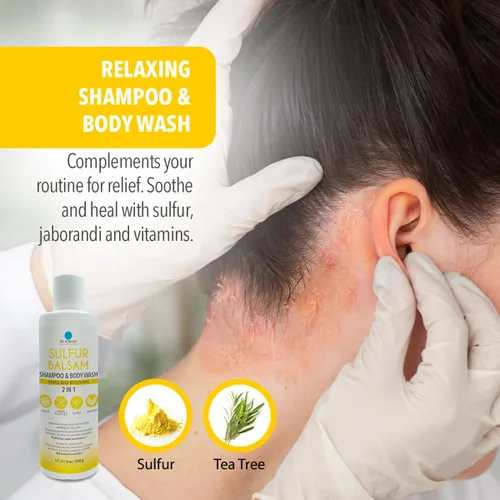 Miniatura 4 de Dr. Robaina Champú de azufre y gel de baño – Ayuda a calmar la caspa, la dermatitis seborreica, la foliculitis y la picazón del cuero cabelludo